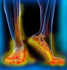 8 reasons your feet are tingling and what to do about&nbsp;it…