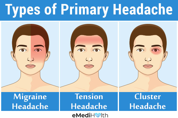 Type of Headaches You Should Never&nbsp;Ignore…