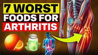 7 Foods To Avoid If You Have&nbsp;Arthritis