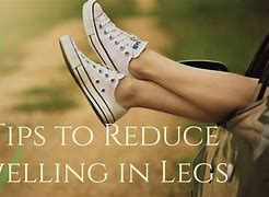 How can I prevent leg swelling? Here’s what the experts&nbsp;recommend