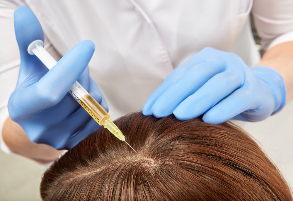 How to Maximize the Benefits of Plasma Injection for&nbsp;Hair?