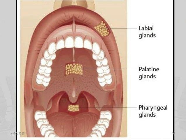 Understanding Pleomorphic Adenoma: A Common Benign&nbsp;Tumor