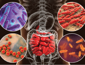 ROLE OF MICROBIOME IN AUTO IMMUNE&nbsp;DISEASES